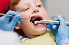 Dental Fillings Bodrum