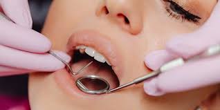 Dental Fillings Bodrum