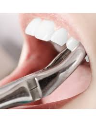 Complicated Extraction Bodrum