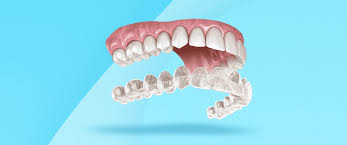 Clear Aligners Bodrum