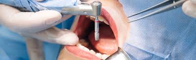 Dental  Surgery in Bodrum