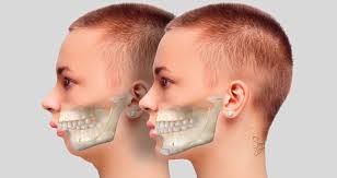 Dental  Surgery in Bodrum
