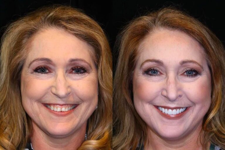 Dental Treatment in Bodrum