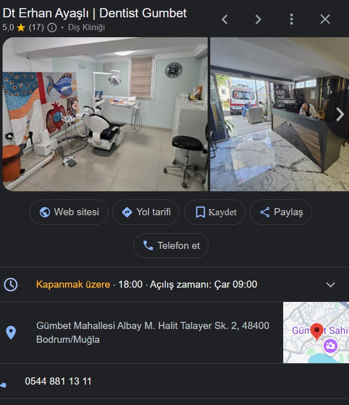 How to Go to Dentist Gumbet