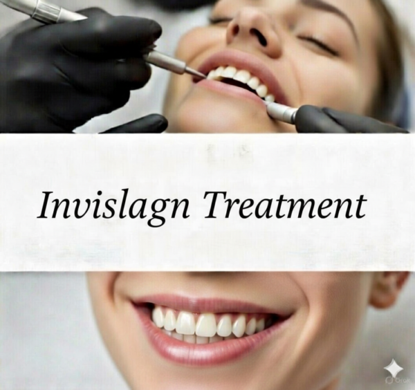 Invisalign Treatment